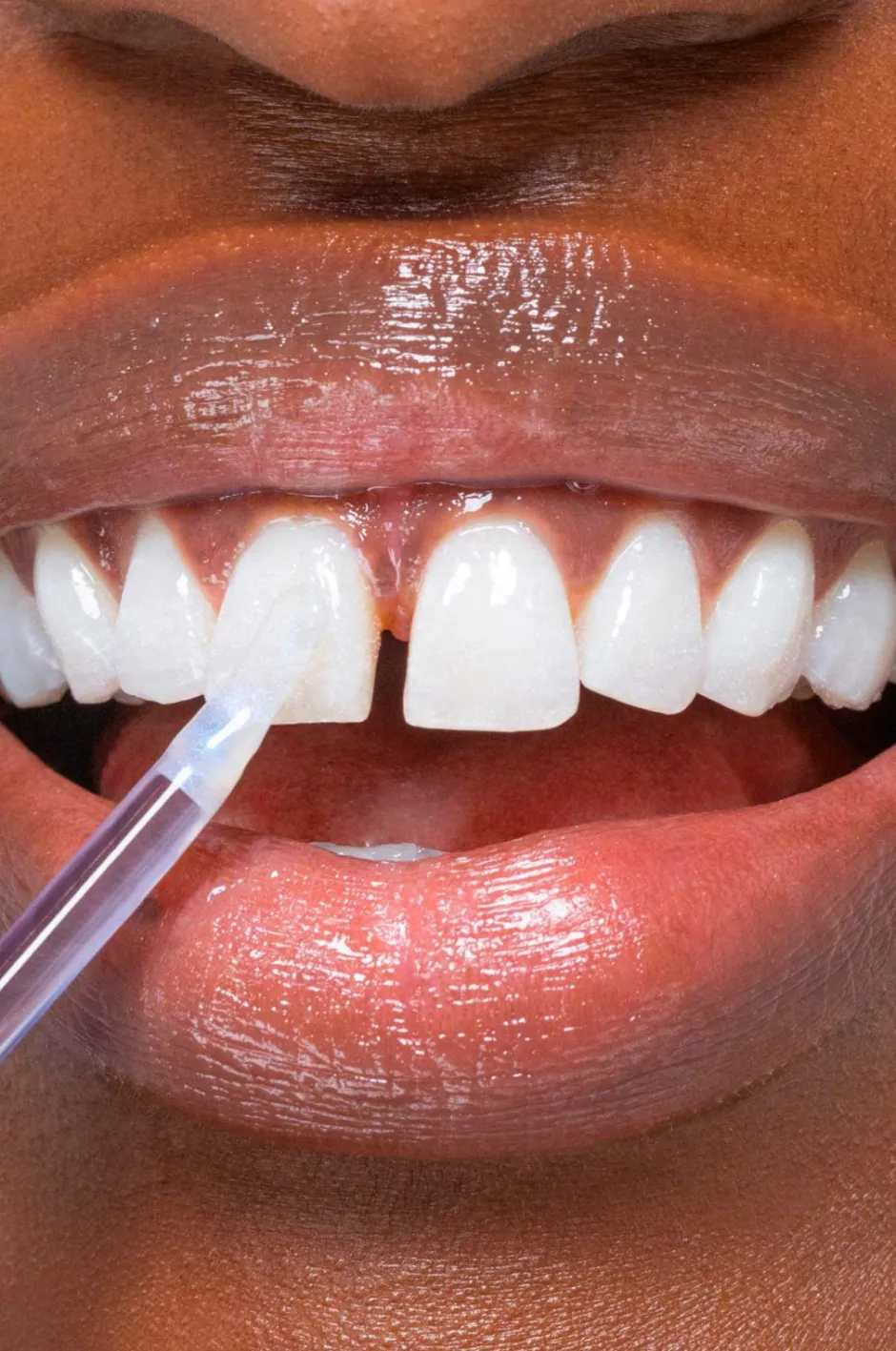 Hismile Glostik Tooth Gloss 4 ml^ Tandpleje