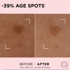 Hot Age Perfect Age Spot Rapid Corrector For Normal Skin 30 Ml Ansigtspleje|Ansigtspleje