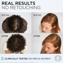 L'Oréal Paris Elvital Growth Booster Conditioner Against Hair Loss 150 Ml^ Hårpleje